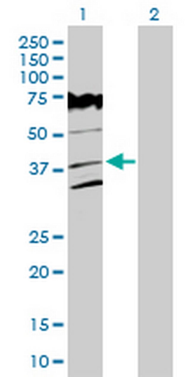 VPS26A Antibody in Western Blot (WB)