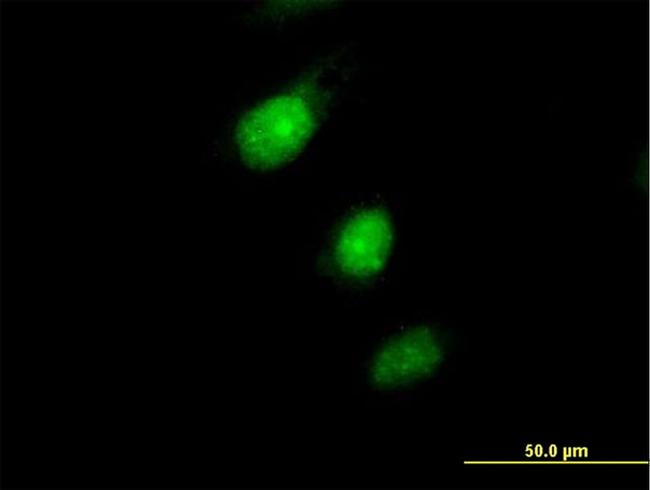 MAD2L1BP Antibody in Immunocytochemistry (ICC/IF)