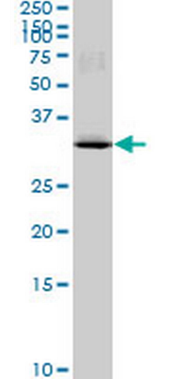 MAD2L1BP Antibody in Western Blot (WB)