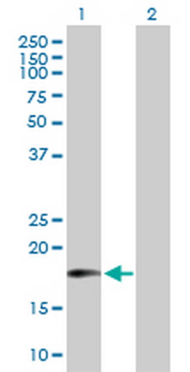 MTRF1 Antibody in Western Blot (WB)