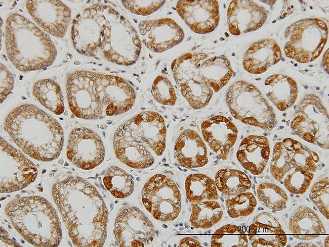 AATK Antibody in Immunohistochemistry (Paraffin) (IHC (P))