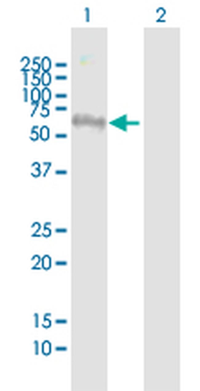 FEZ1 Antibody in Western Blot (WB)