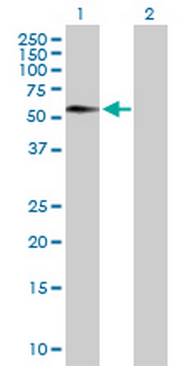 FEZ1 Antibody in Western Blot (WB)