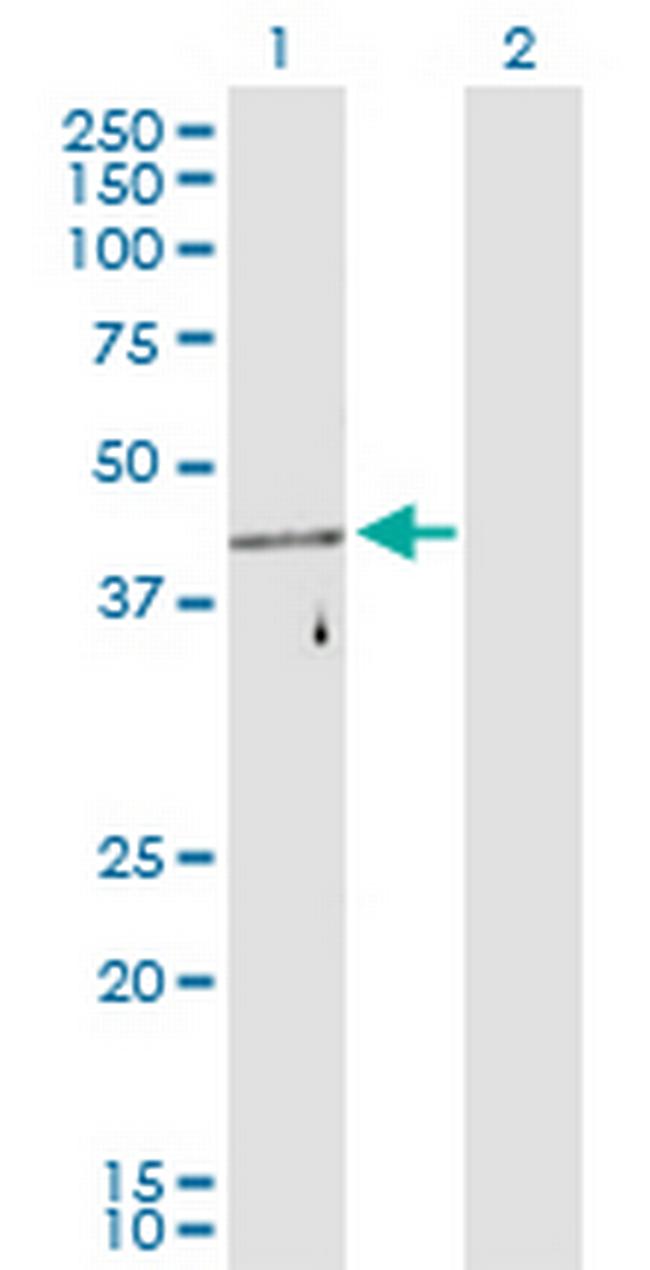 FEZ1 Antibody in Western Blot (WB)