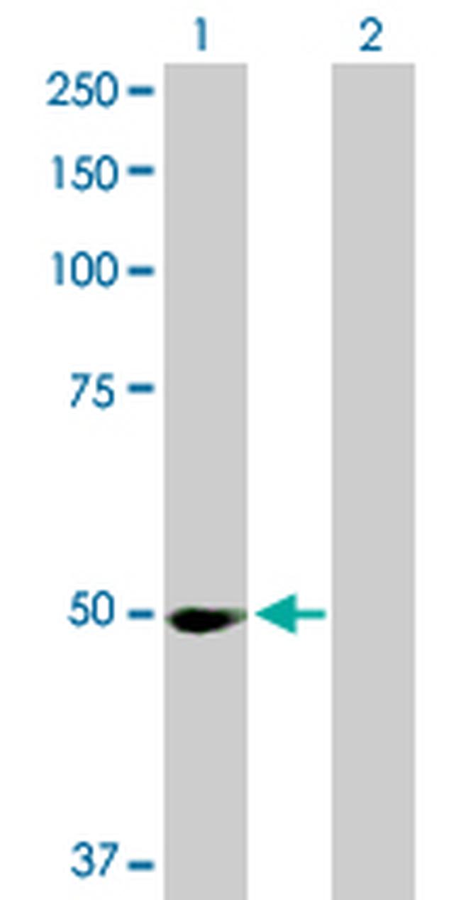 PPM1F Antibody in Western Blot (WB)