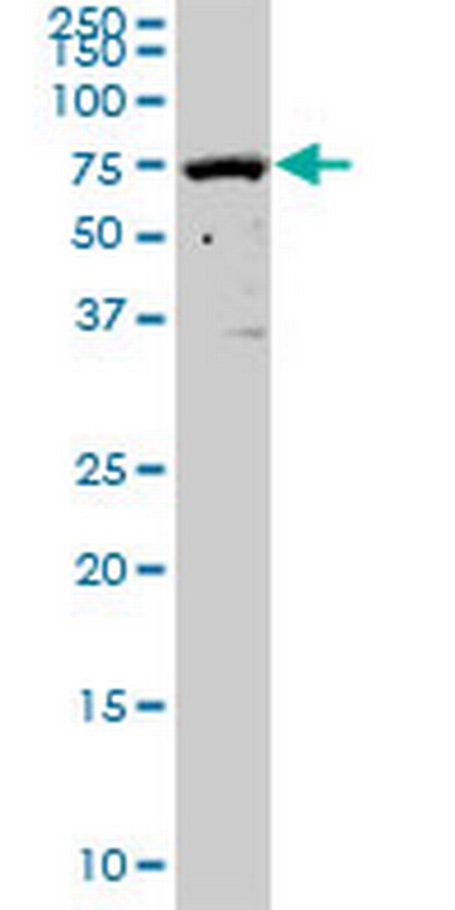 SOCS5 Antibody in Western Blot (WB)