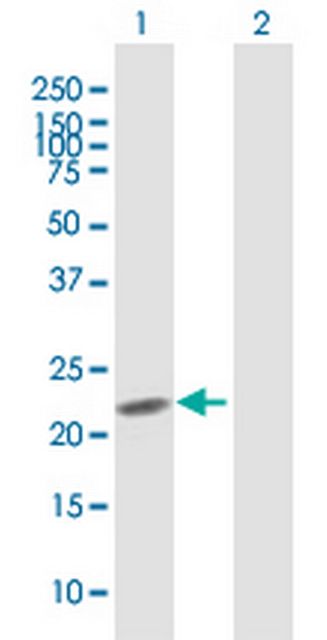 PDE4DIP Antibody in Western Blot (WB)