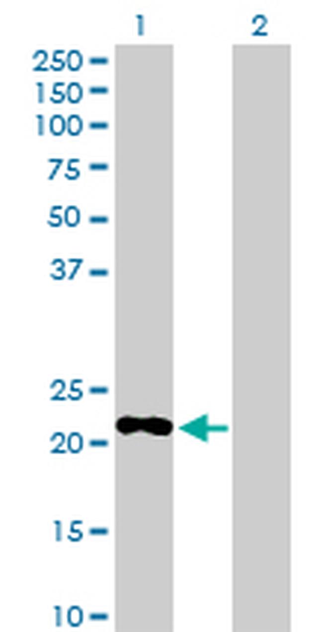 PDE4DIP Antibody in Western Blot (WB)