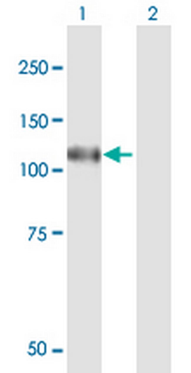 N4BP1 Antibody in Western Blot (WB)