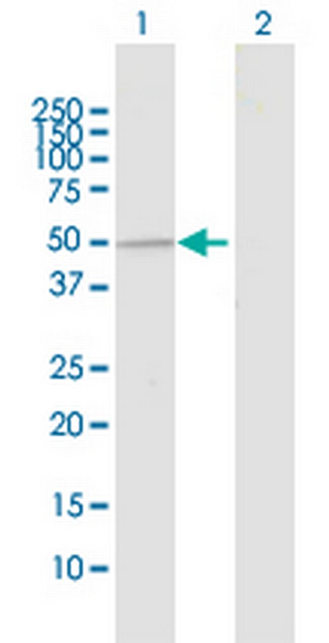 UBE3C Antibody in Western Blot (WB)