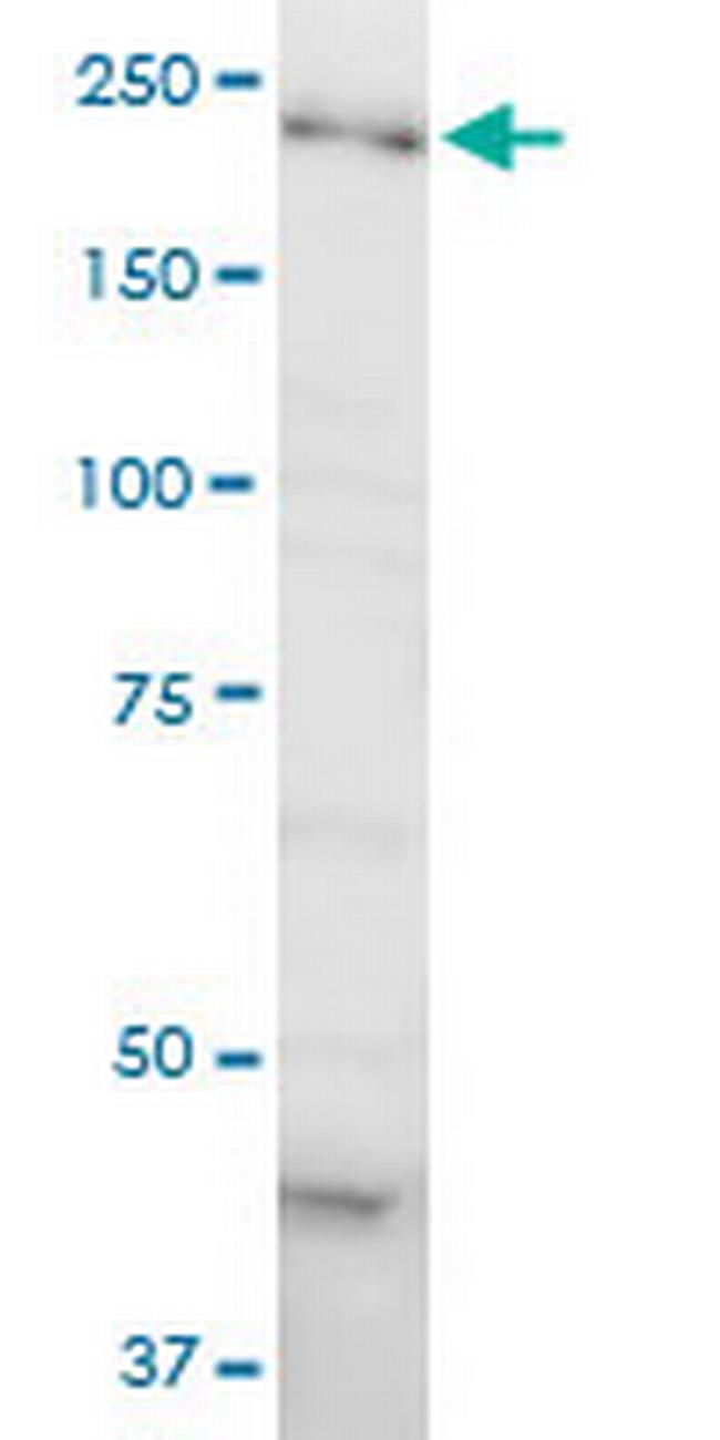 DOCK4 Antibody in Western Blot (WB)