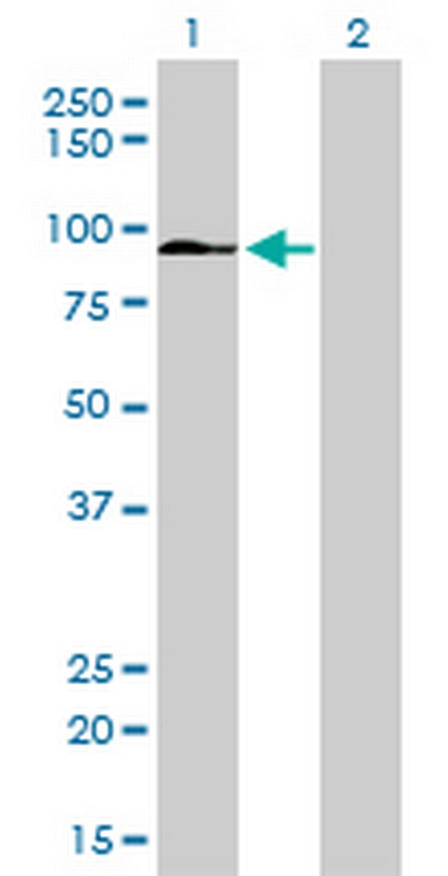 ZFYVE16 Antibody in Western Blot (WB)