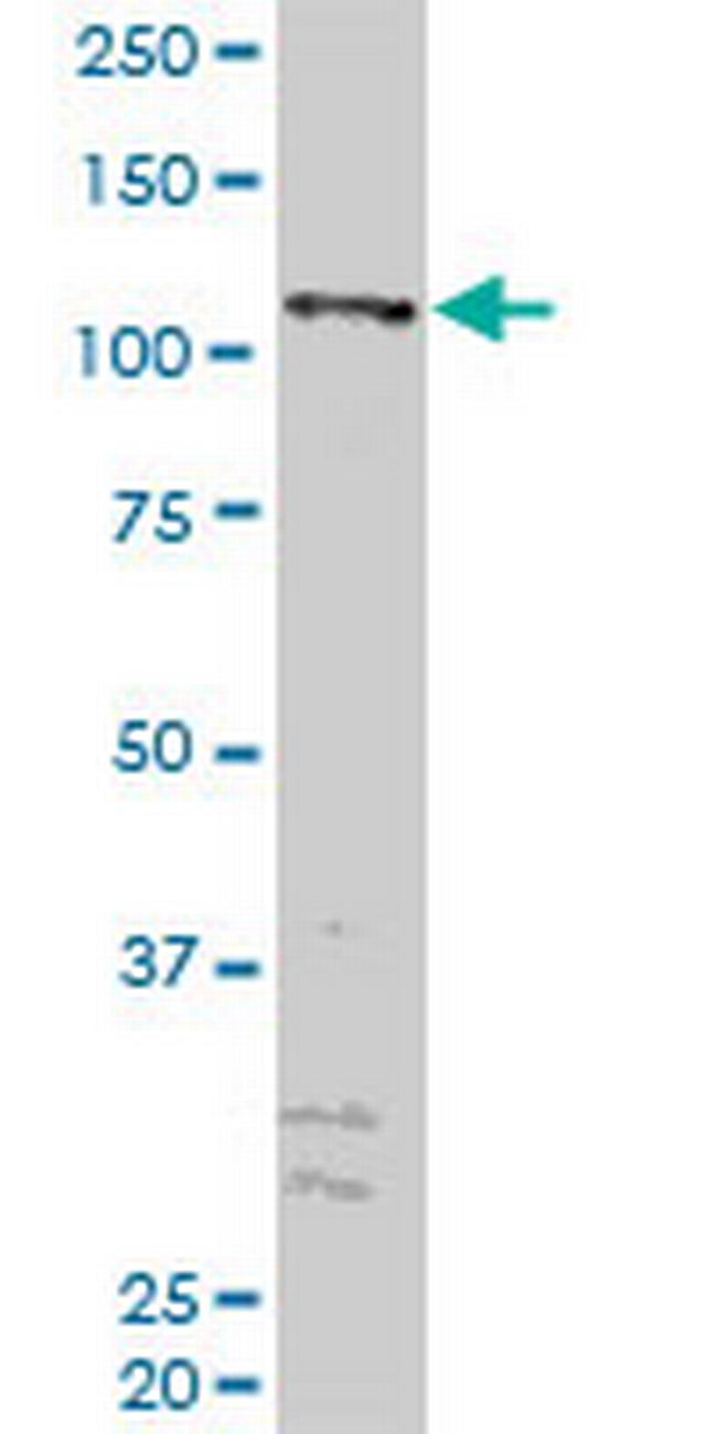 ZFYVE16 Antibody in Western Blot (WB)