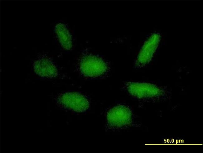 RAPGEF5 Antibody in Immunocytochemistry (ICC/IF)