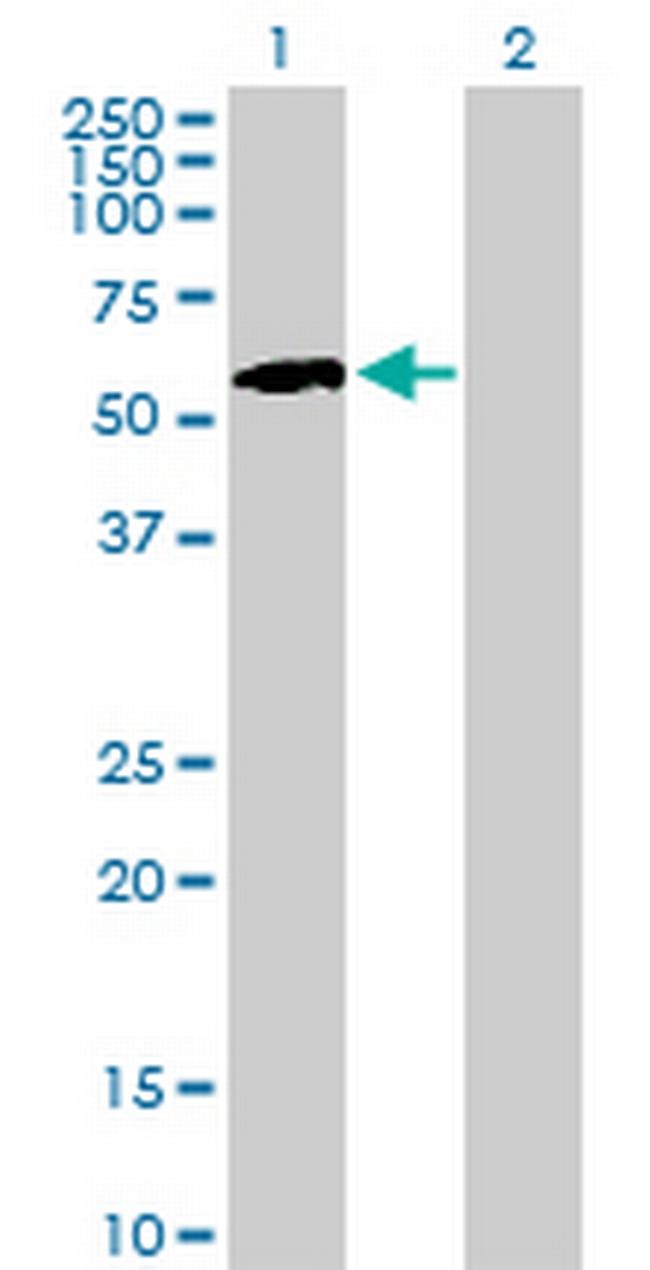 IHPK1 Antibody in Western Blot (WB)