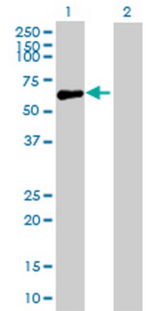 GIT2 Antibody in Western Blot (WB)