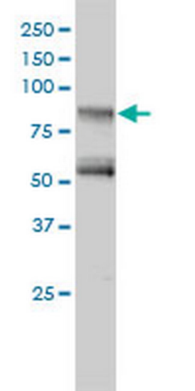 GIT2 Antibody in Western Blot (WB)