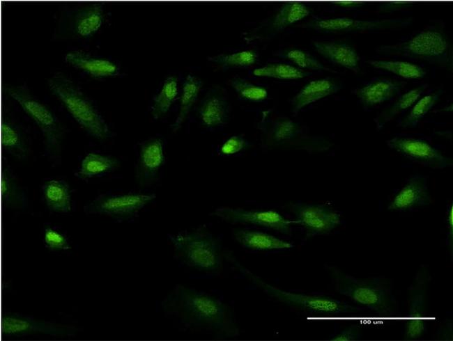 GIT2 Antibody in Immunocytochemistry (ICC/IF)