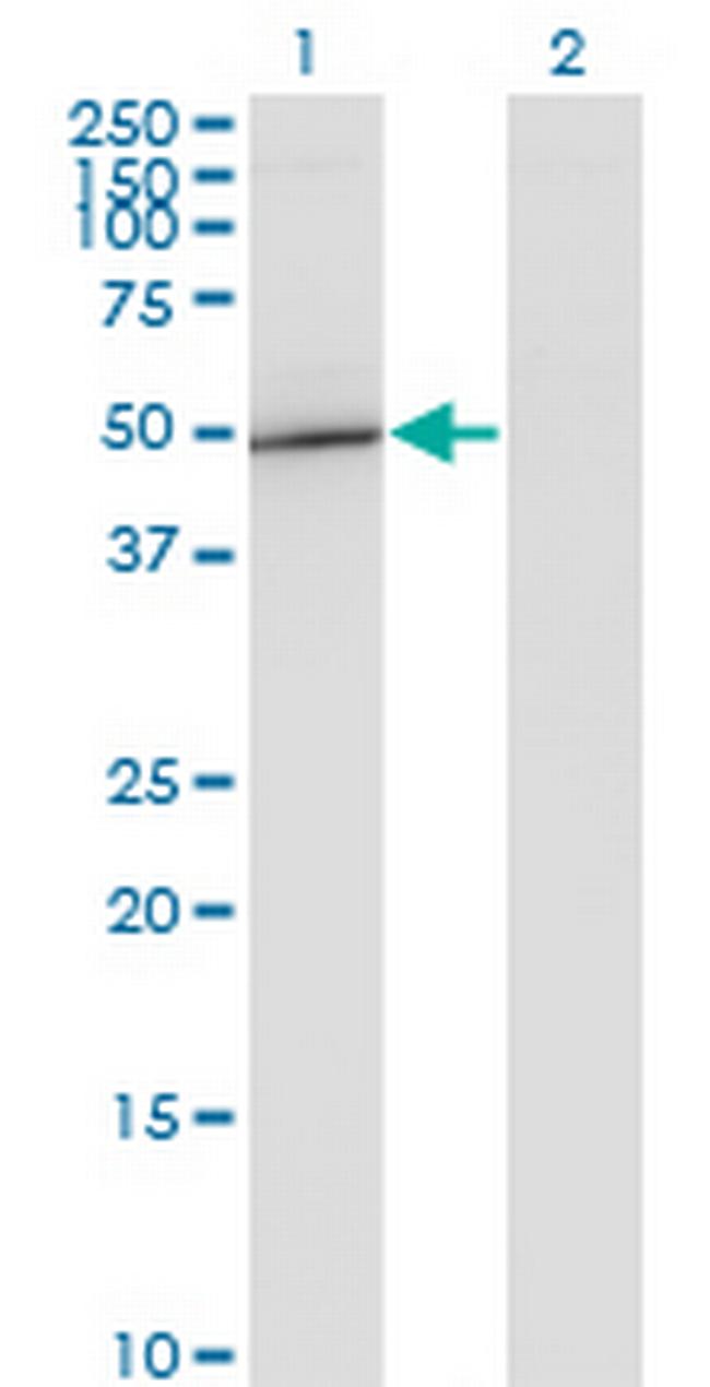 GIT2 Antibody in Western Blot (WB)