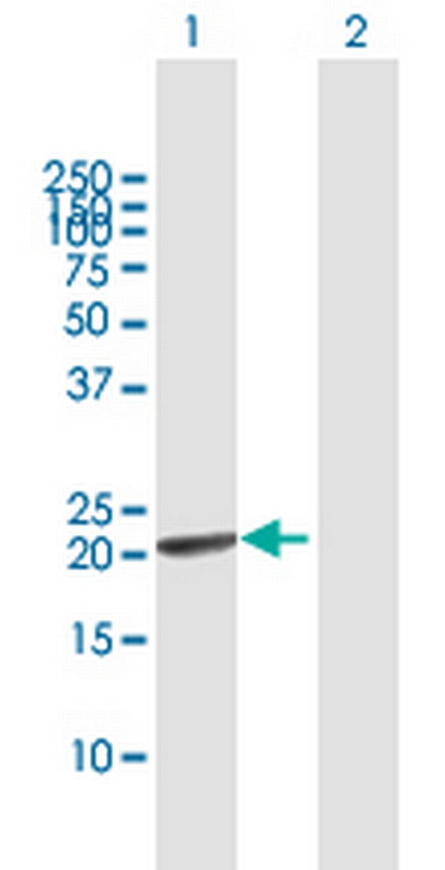 GINS1 Antibody in Western Blot (WB)