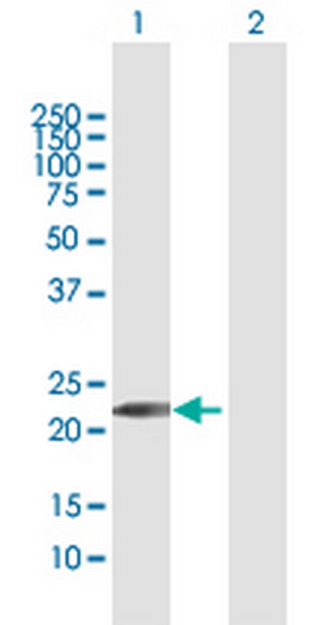 GINS1 Antibody in Western Blot (WB)