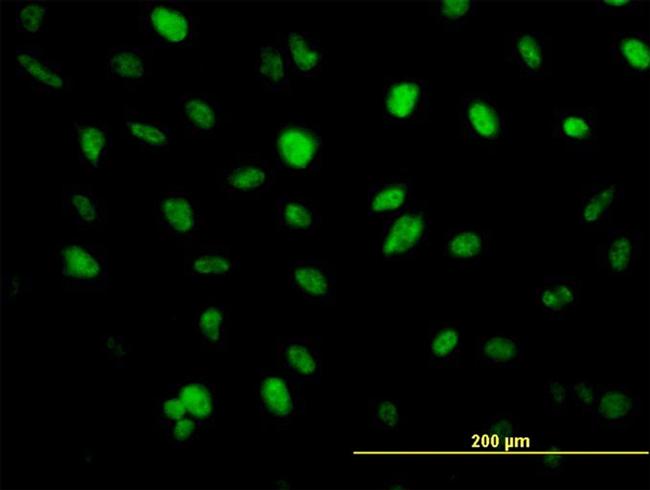 ZFHX1B Antibody in Immunocytochemistry (ICC/IF)