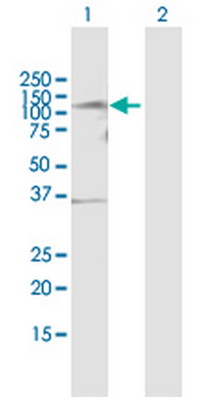 TLK1 Antibody in Western Blot (WB)