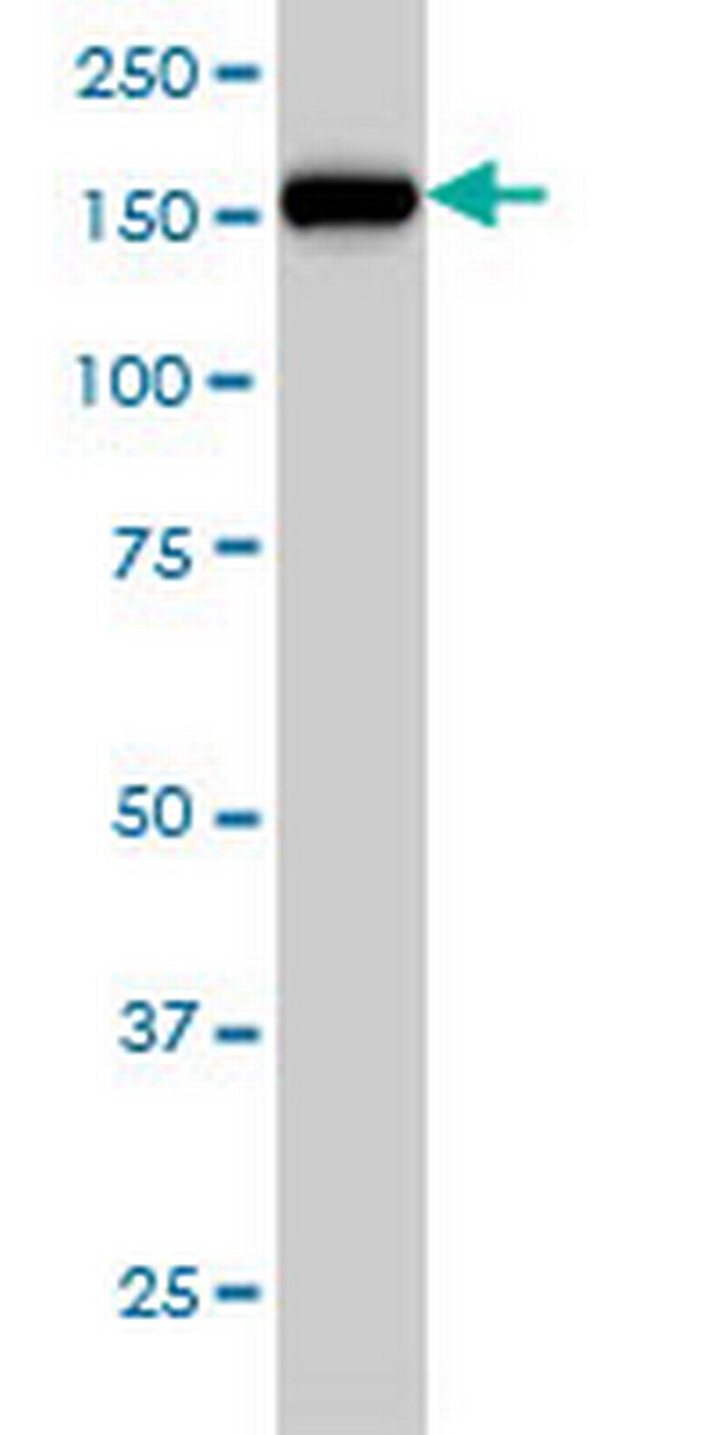 CNAP1 Antibody in Western Blot (WB)