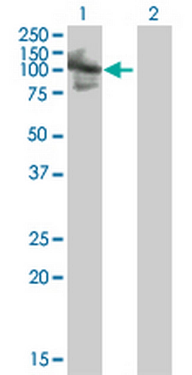 RNF10 Antibody in Western Blot (WB)