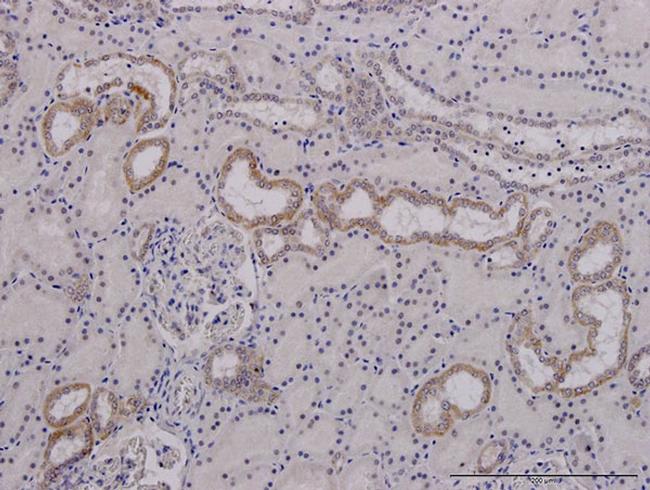 MFN2 Antibody in Immunohistochemistry (Paraffin) (IHC (P))