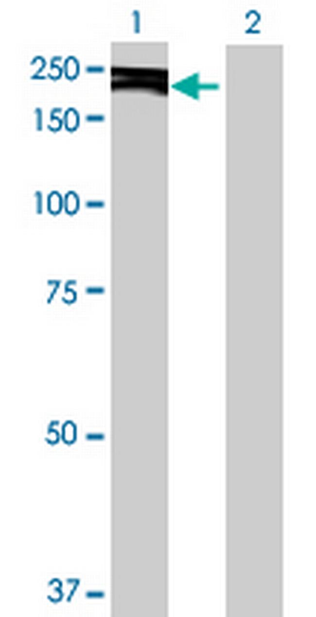 KIF14 Antibody in Western Blot (WB)