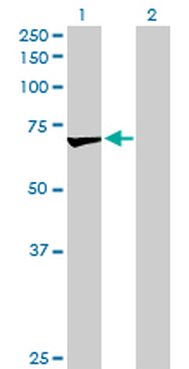 OXSR1 Antibody in Western Blot (WB)