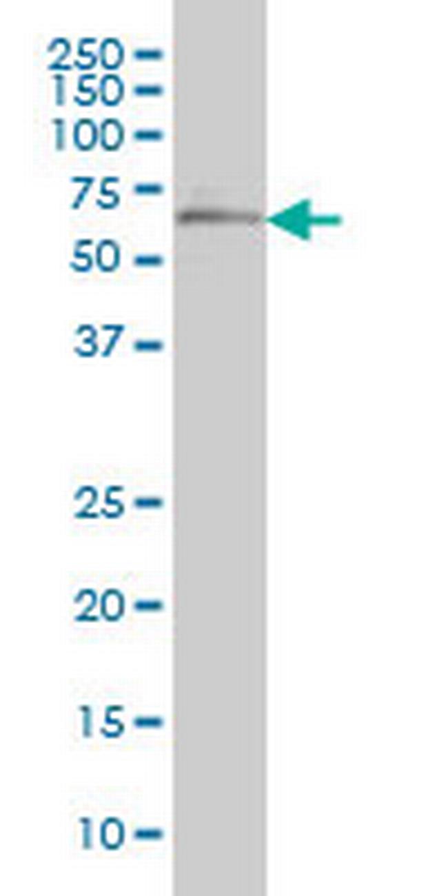 OXSR1 Antibody in Western Blot (WB)