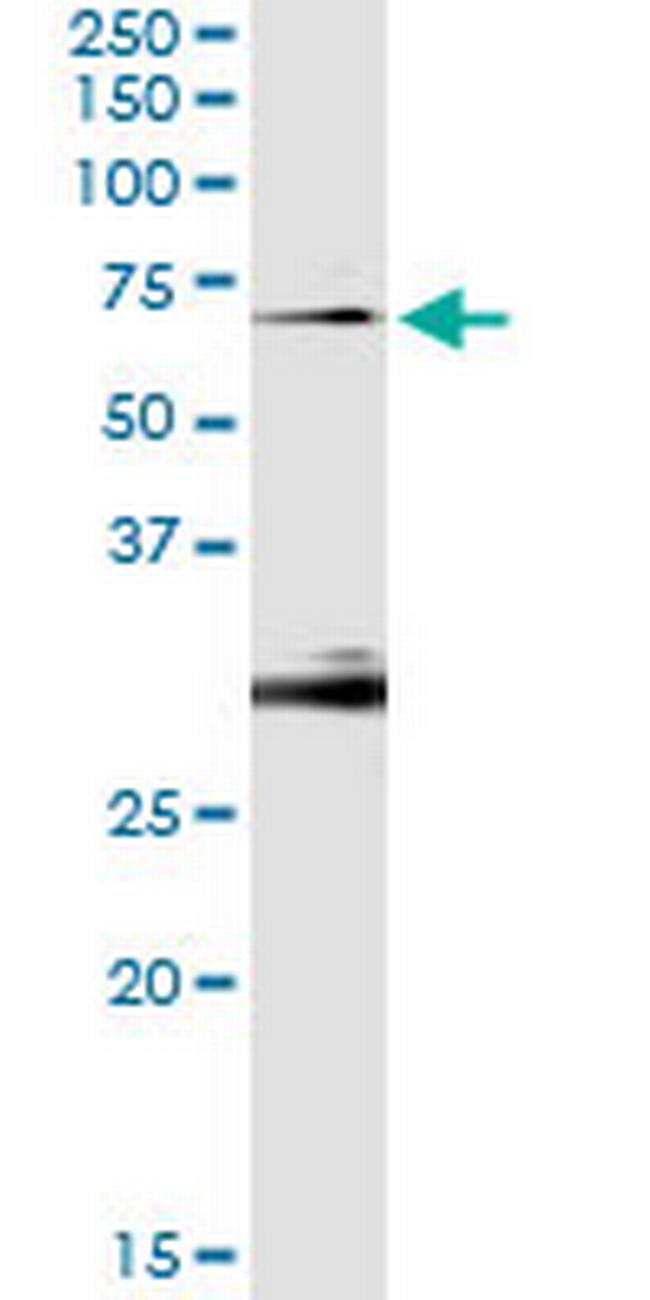 OXSR1 Antibody in Immunoprecipitation (IP)