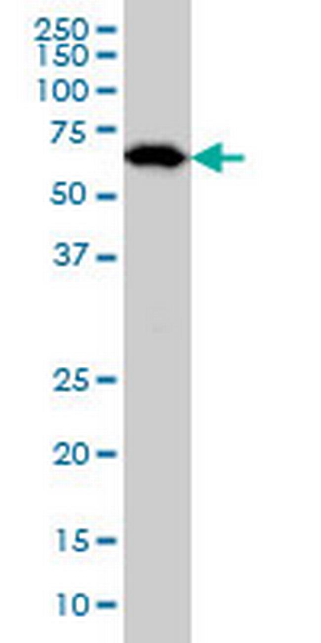 OXSR1 Antibody in Western Blot (WB)