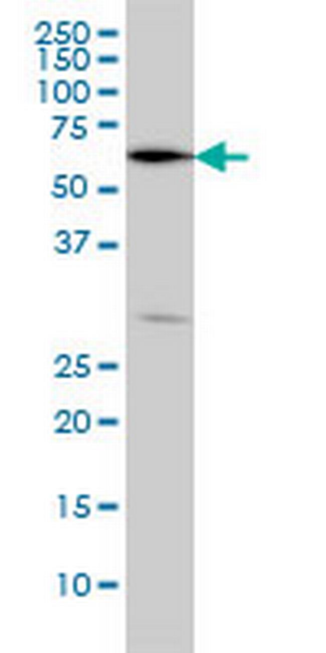 OXSR1 Antibody in Western Blot (WB)