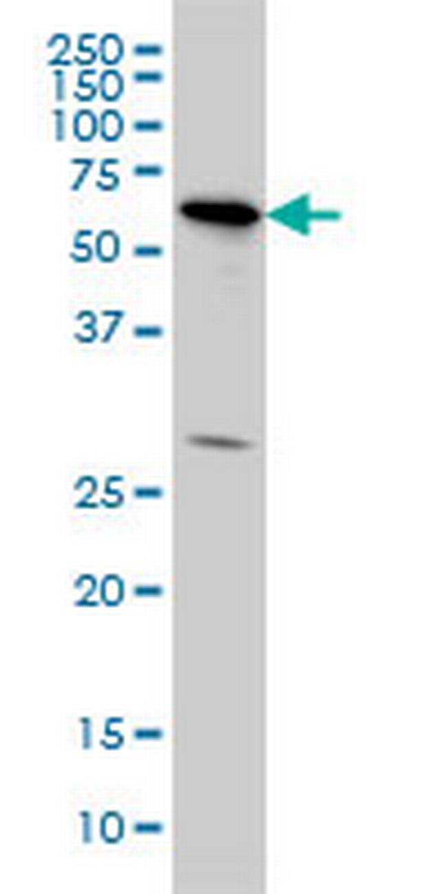 OXSR1 Antibody in Western Blot (WB)