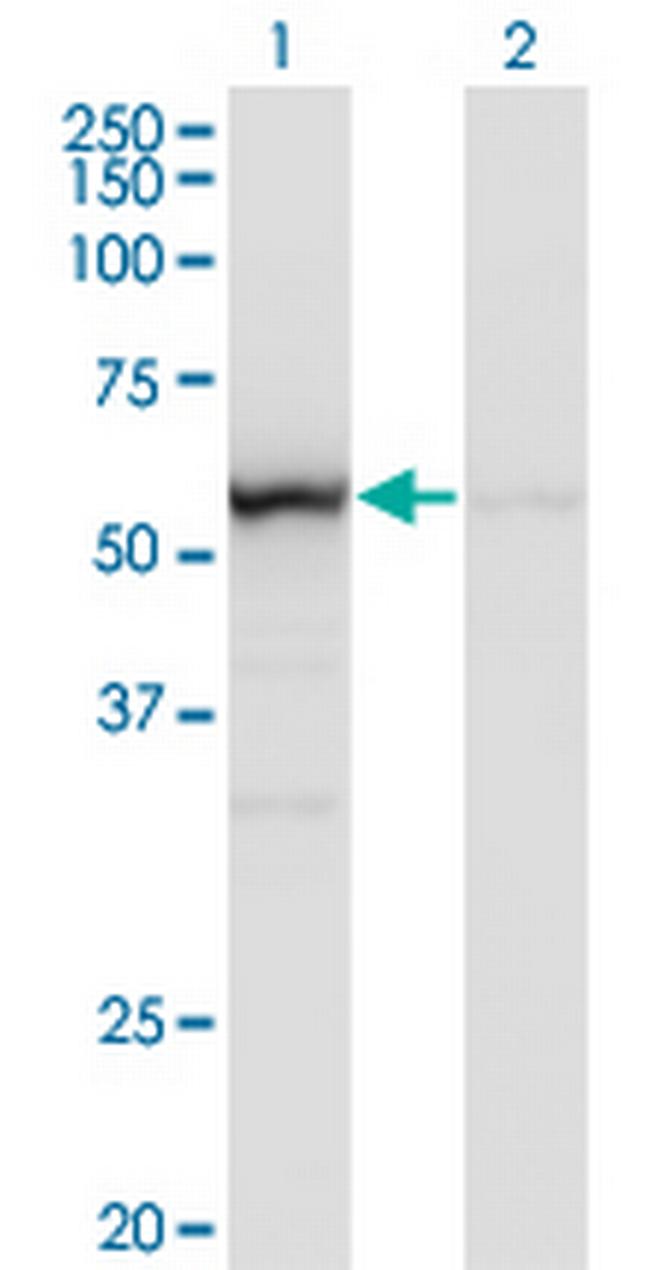 OXSR1 Antibody in Western Blot (WB)