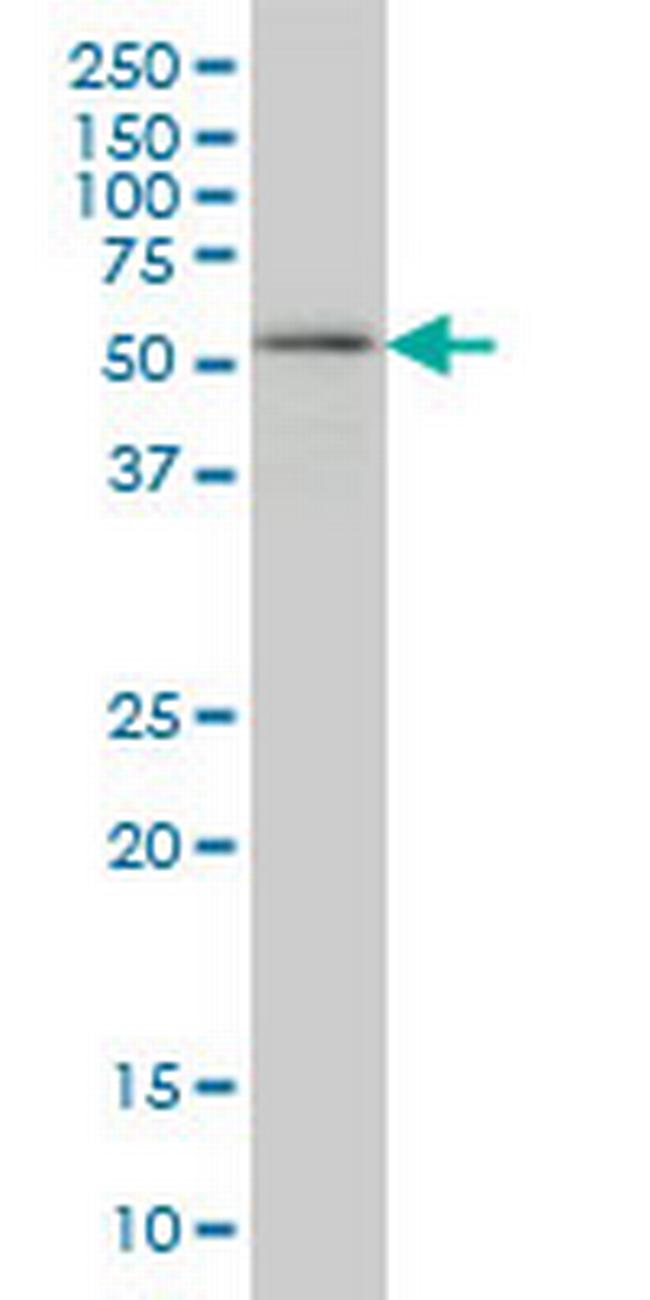 OXSR1 Antibody in Western Blot (WB)