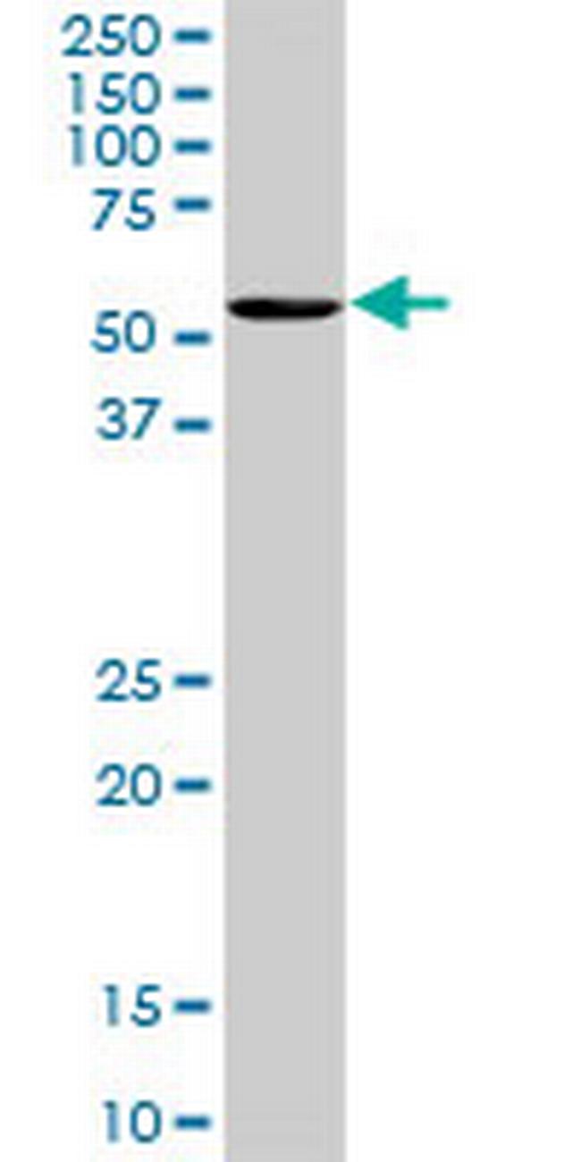 OXSR1 Antibody in Western Blot (WB)