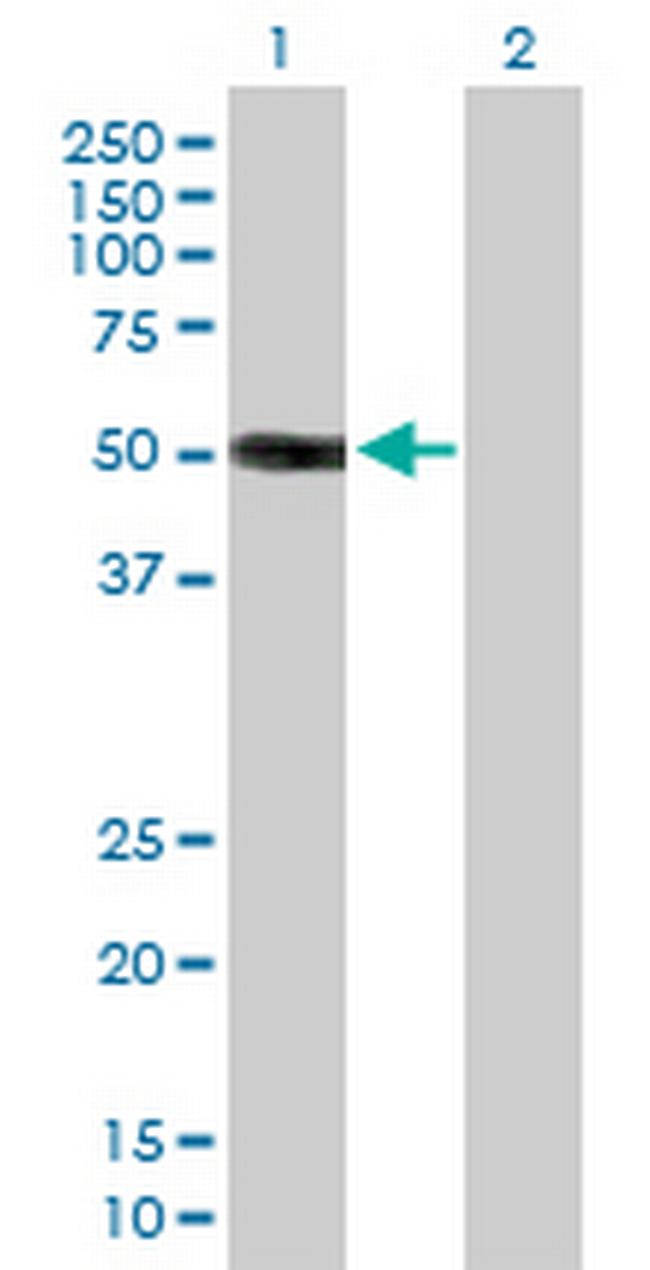 HS3ST3A1 Antibody in Western Blot (WB)