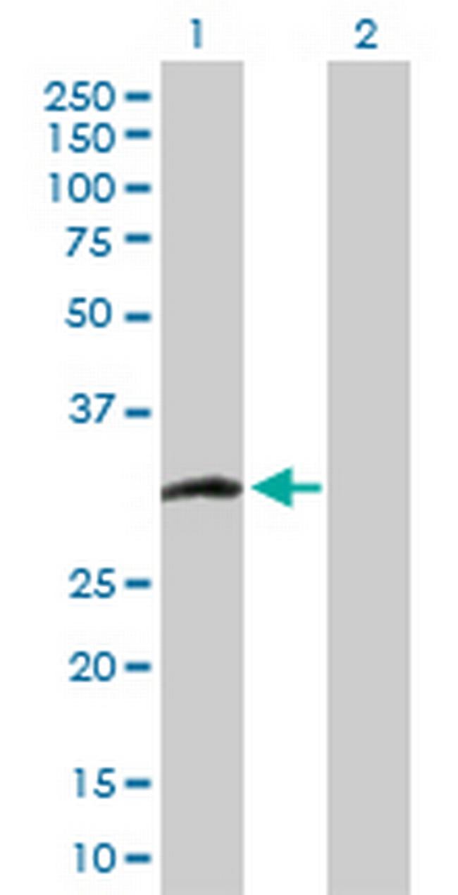 CCS Antibody in Western Blot (WB)