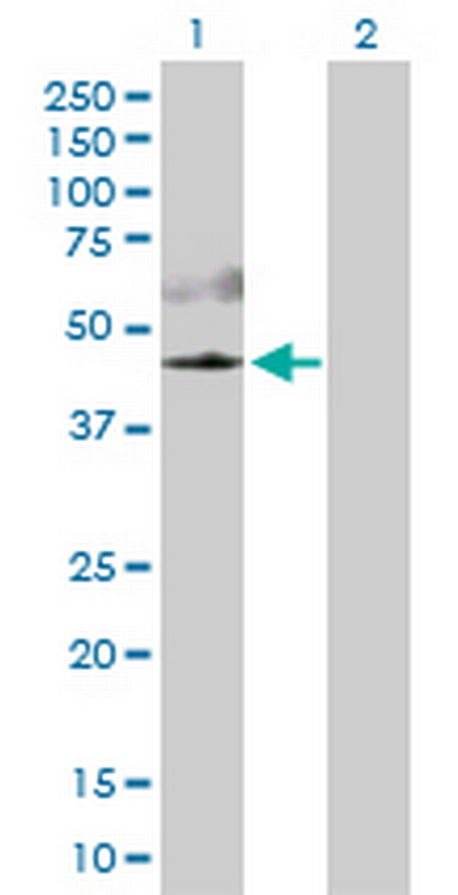 AKT3 Antibody in Western Blot (WB)