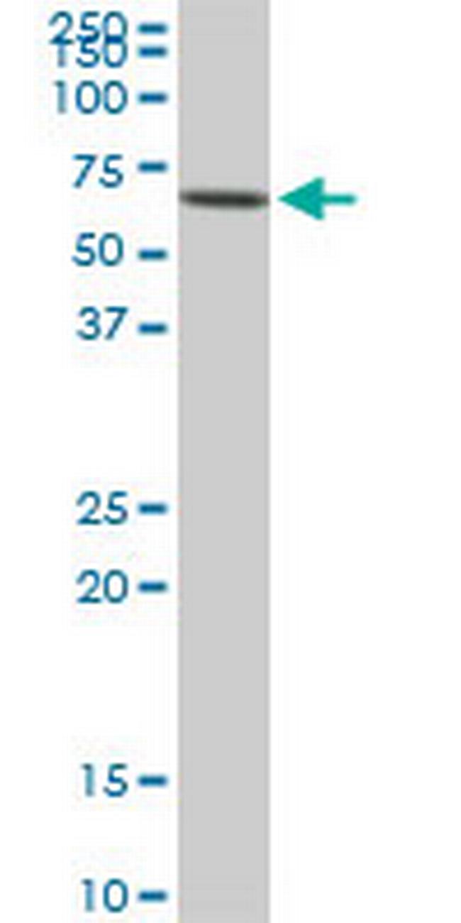 AKT3 Antibody in Western Blot (WB)