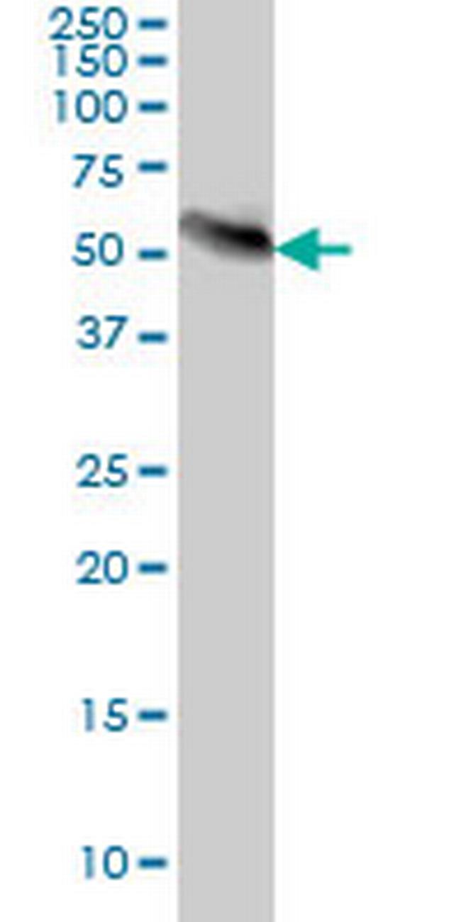 AKT3 Antibody in Western Blot (WB)