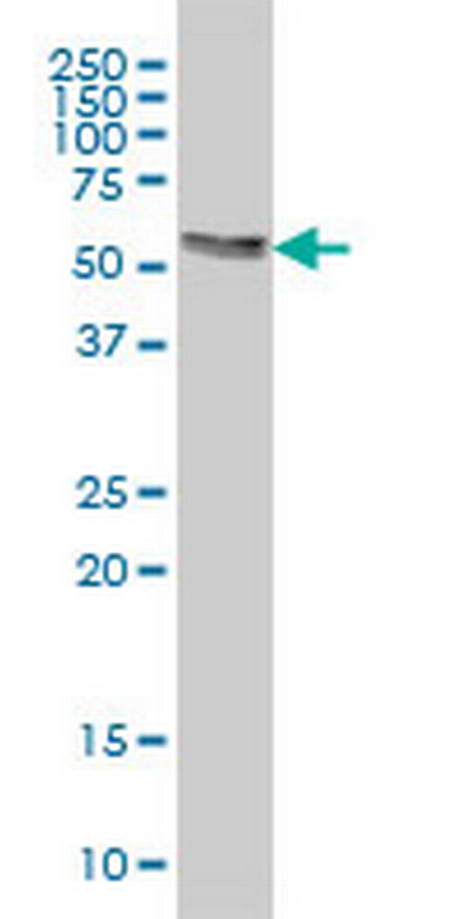 AKT3 Antibody in Western Blot (WB)