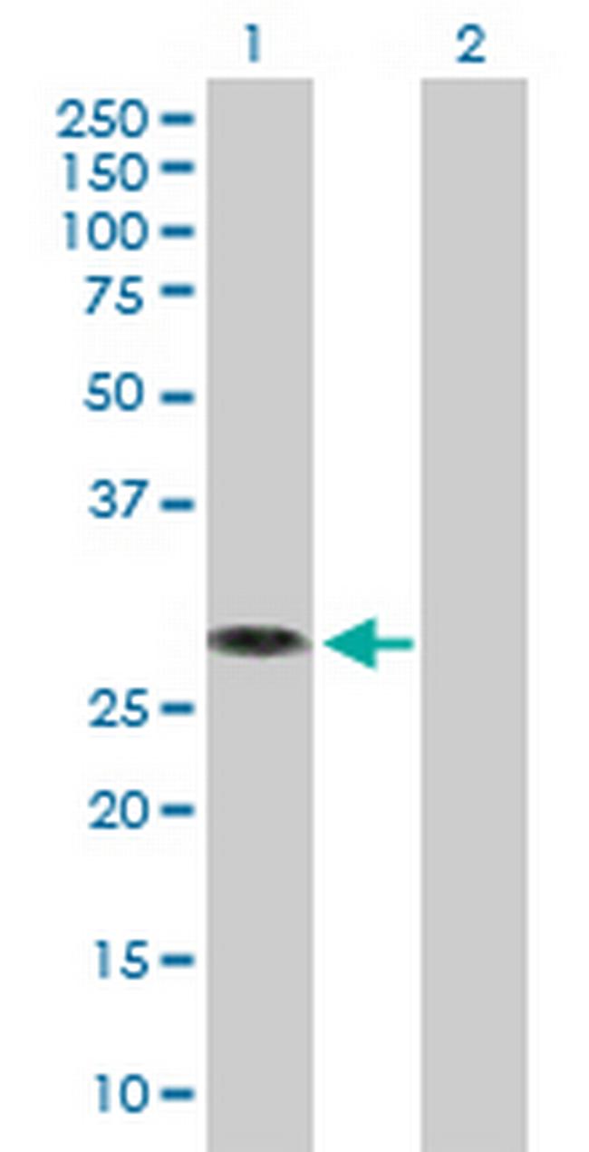 MED6 Antibody in Western Blot (WB)