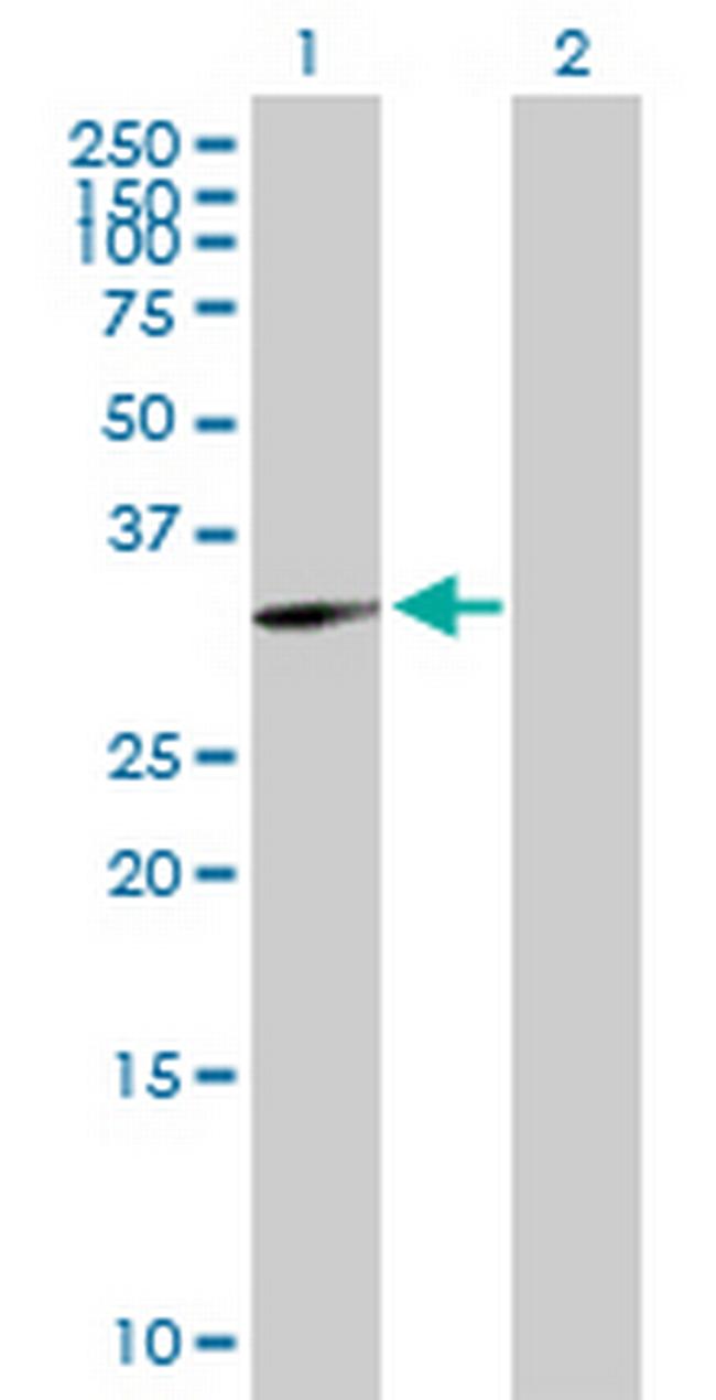 GNPDA1 Antibody in Western Blot (WB)