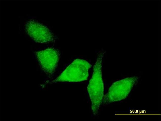 HDAC6 Antibody in Immunocytochemistry (ICC/IF)