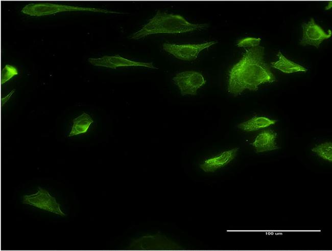 HDAC6 Antibody in Immunocytochemistry (ICC/IF)